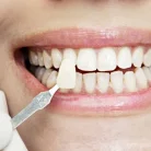 Стоматологическая клиника DentalStyle Фотография 4