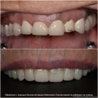 Стоматология Happysmile+ Фотография 14