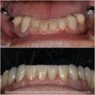 Стоматология Happysmile+ Фотография 18