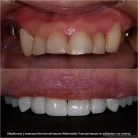 Стоматология Happysmile+ Фотография 19