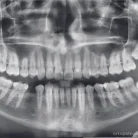 Центр диагностики челюстно-лицевой области Пикассо на проспекте Вернадского Фотография 8