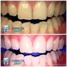 Стоматологическая клиника Esmalta Dent Фотография 8