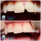 Стоматологическая клиника Esmalta Dent Фотография 4
