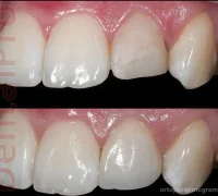 Стоматологическая клиника Dentalpro Фотография 2