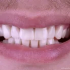 Центр стоматологии и имплантологии West Dental Clinic by Dr. Romantsov Фотография 4