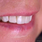 Центр стоматологии и имплантологии West Dental Clinic by Dr. Romantsov Фотография 6