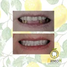 Стоматология Лимон Фотография 7