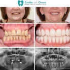 Стоматология Smile-at-Once на улице Станиславского Фотография 6