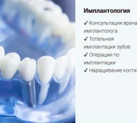 Стоматологический центр имплантации и ортодонтии Дэнталюкс Фотография 2
