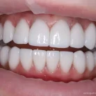 Стоматология Доктора Хачатуряна Best Smile Clinic Фотография 3
