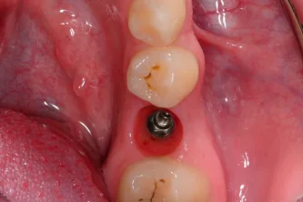 Стоматология Brainmark dental studio на Велозаводской улице Фотография 2